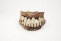 Denture, false teeth Image preview