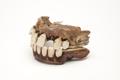 Denture, false teeth Image preview