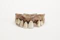 Denture, false teeth Image preview