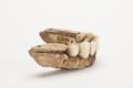 Denture, false teeth Image preview
