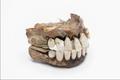 Denture, false teeth Image preview